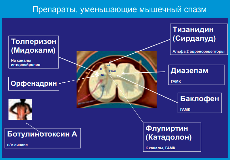 Остеохондроз грудного отдела